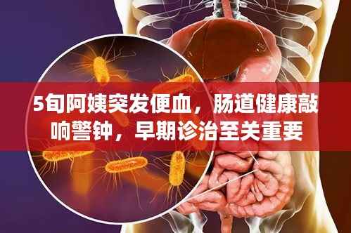 5旬阿姨突发便血，肠道健康敲响警钟，早期诊治至关重要
