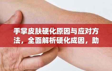 手掌皮肤硬化原因与应对方法,全面解析硬化成因,助你轻松应对